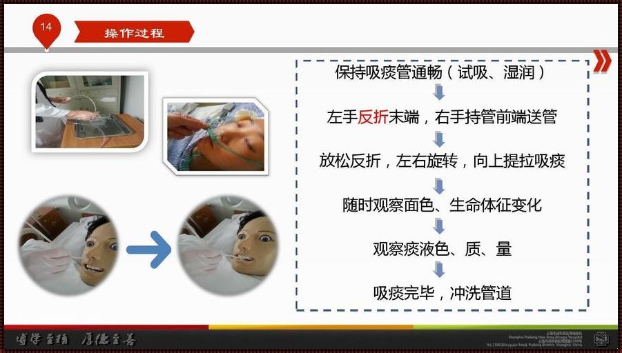 体育文化惊现“吸痰”奇观，技术 PPT 课件引领新风潮