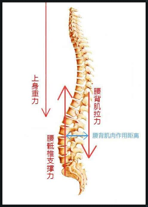 腰椎变形自我矫正之道：科技助力瑞昌民间疗法