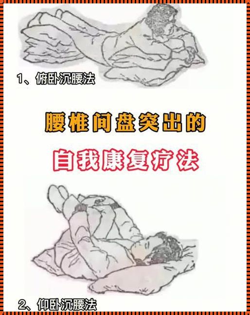 腰椎后凸治疗新探：口腔牙科领域的惊现之作