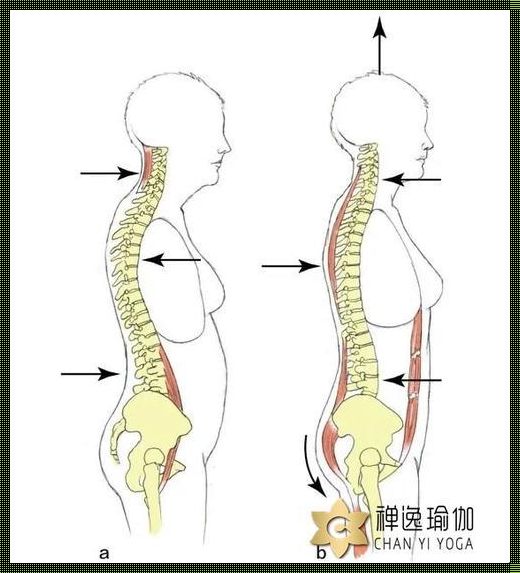 科技惊现：脊柱弯曲的正确“解锁”