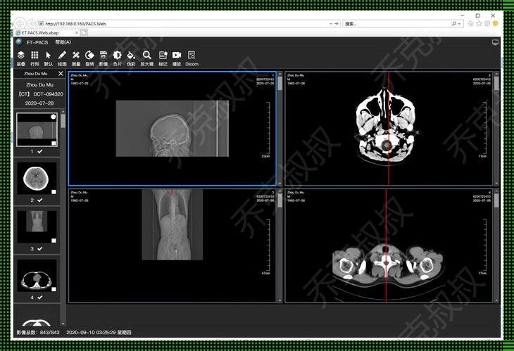 医学图像处理软件：问鼎医疗领域的前沿技术