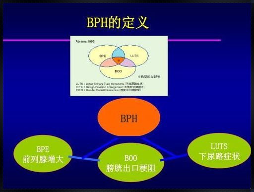 LUTS医学概念：探寻前列腺疾病的神秘面纱