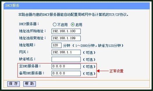 正常DNS配置是什么：揭开神秘面纱