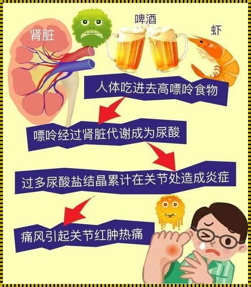 科技守护健康：男性高尿酸的预防新策略